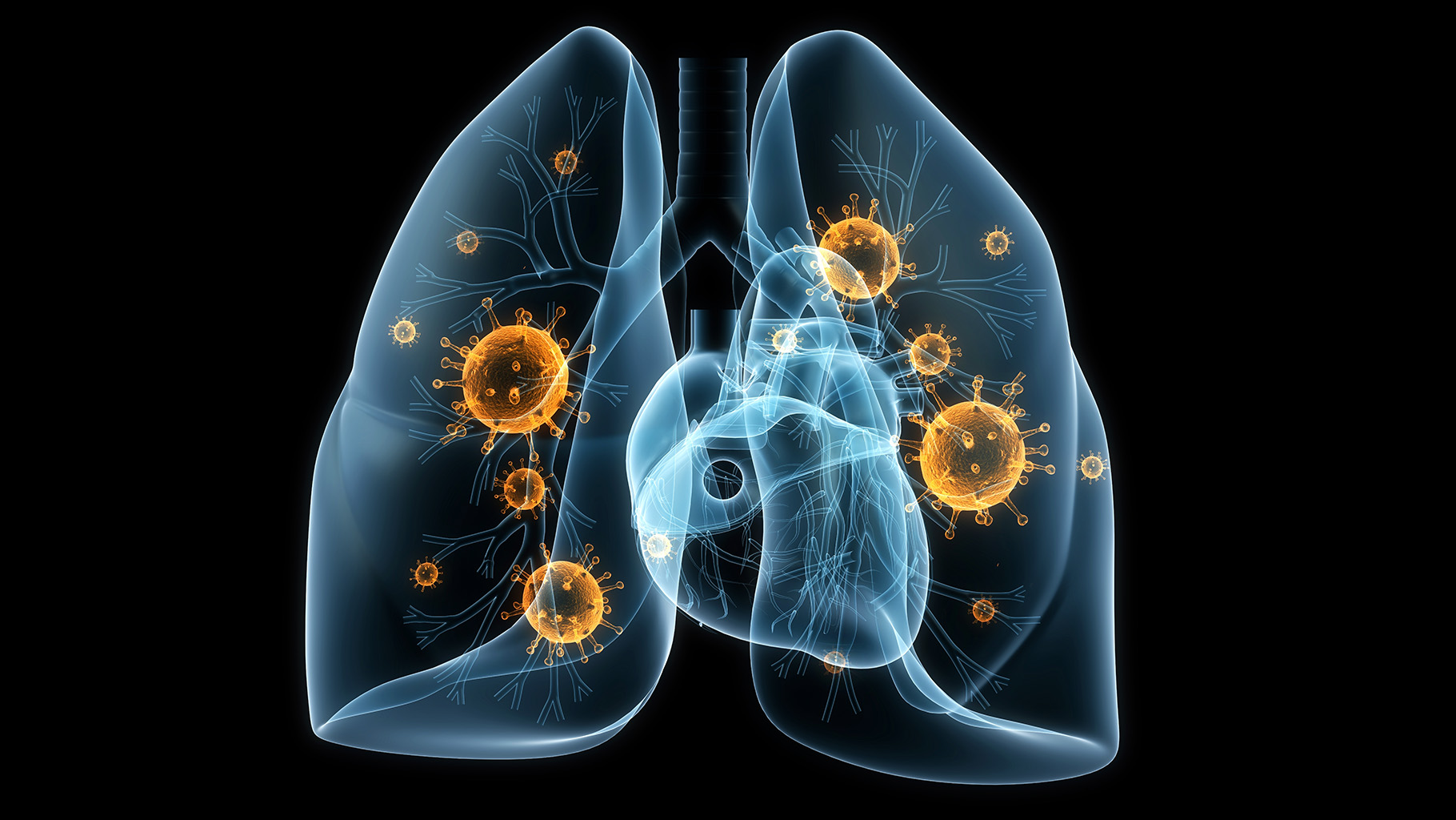 Coronavirus Italia - prevenire il coronavirus COVID-19 in Italia con AIRsteril - cos'è il coronavirus